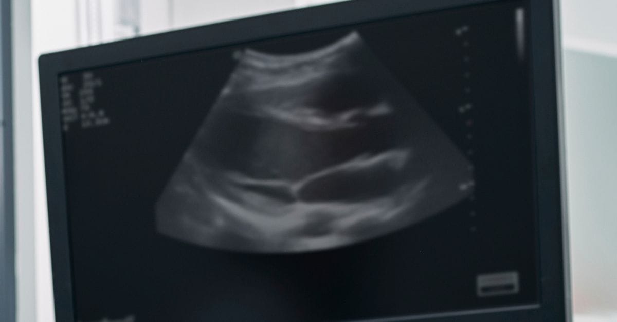 SMART Launches Wearable Ultrasound Imaging Research Centre