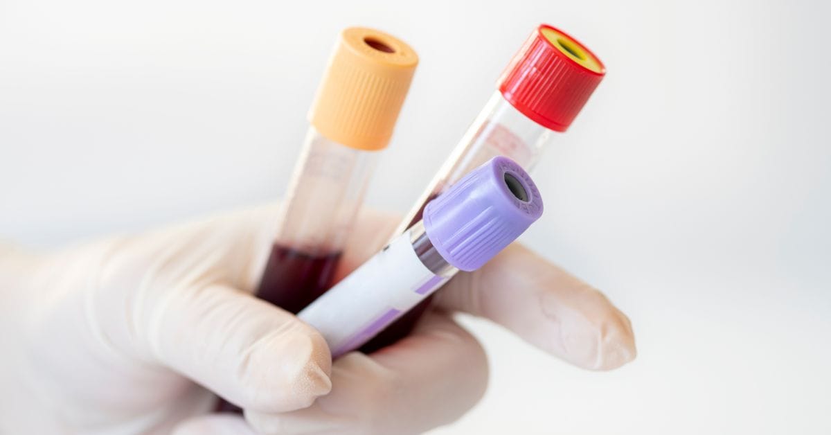 Guardant Health Launches Multi-Cancer Blood Test in APAC