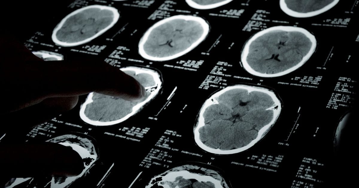 HKSH Named Siemens Healthineers Photon-Counting CT Site
