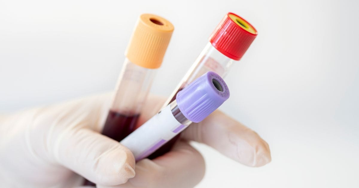 Singapore Launches Clinical Studies on Multi-Cancer Detection Tests