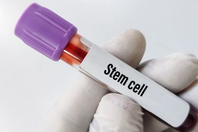 Cordex-Biologics-Grants-FarmaMondo-Distribution-Rights-for-Zemcelpro®.jpg