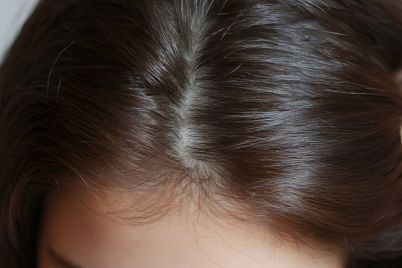 DFI-Retail-and-Becon-Launch-AI-Skin-Scalp-Assessments-in-Asia.jpg