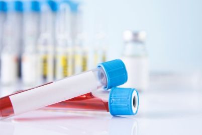 Gene-Solutions-Validates-Asias-First-Multi-Cancer-Blood-Test.jpg