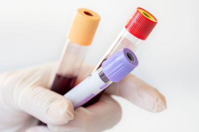 Guardant-Health-Launches-Multi-Cancer-Blood-Test-in-APAC.jpg