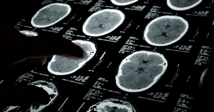 HKSH Named Siemens Healthineers Photon-Counting CT Site