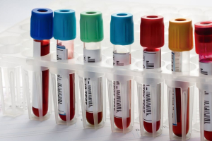 HUYABIO Reports Positive Phase 3 Results for Advanced Melanoma Therapy