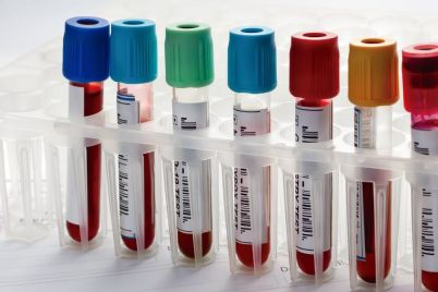 HUYABIO-Reports-Positive-Phase-3-Results-for-Advanced-Melanoma-Therapy.jpg