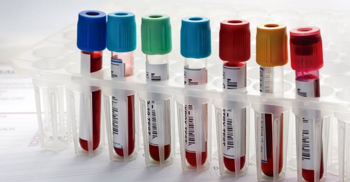 HUYABIO Reports Positive Phase 3 Results for Advanced Melanoma Therapy