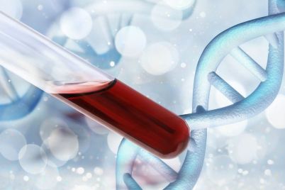 Lucence-Launches-S600-Multicancer-Screening-Test.jpg