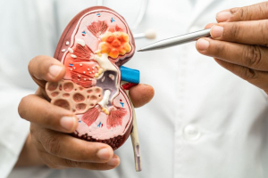 NKF Reports Over 200,000 New CKD Cases in Singapore