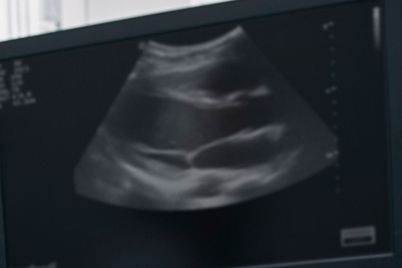 SMART-Launches-Wearable-Ultrasound-Imaging-Research-Centre.jpg