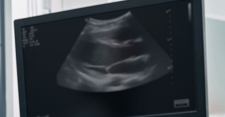 SMART Launches Wearable Ultrasound Imaging Research Centre
