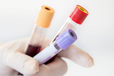 Singapore-Launches-Clinical-Studies-on-Multi-Cancer-Detection-Tests.jpg