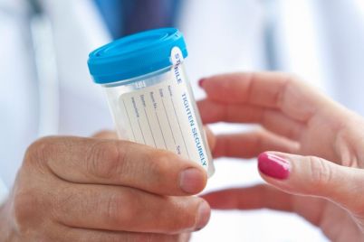 Urine-Proteins-Could-Indicate-Dengue-Severity-in-Future-Tests.jpg